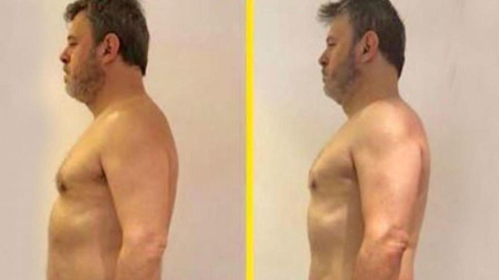 Miki Nadal con 10 kilos menos