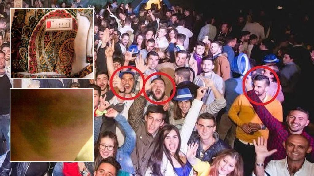 Imagen del vestido roto y del cardenal de la joven de 21 años que sufrió presuntos abusos sexuales de 'la Manada' el 1 de mayo de 2016.