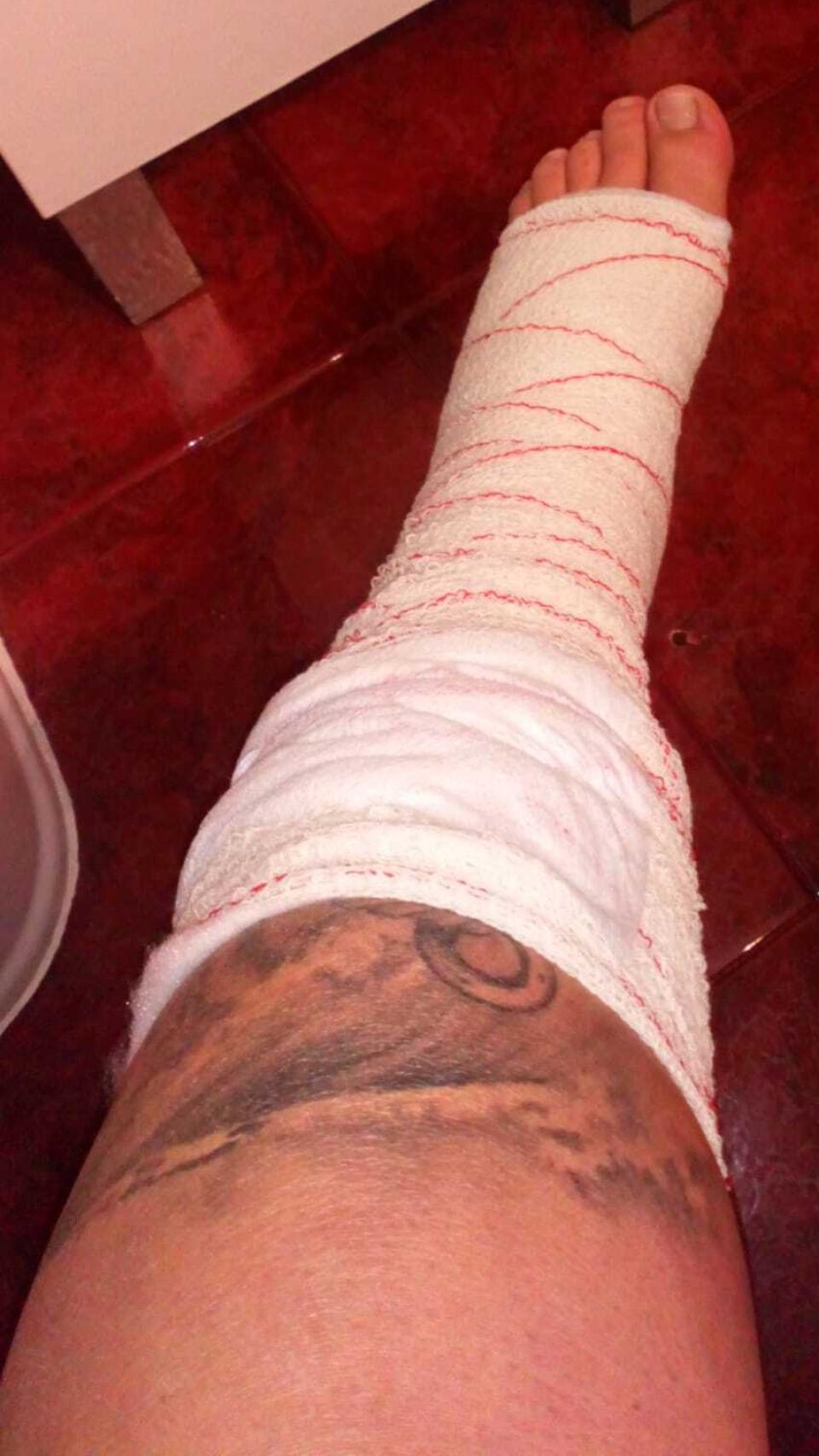 Laura tiene un 24% de discapacidad, un punto debajo de lo necesario para cobrar pensión.