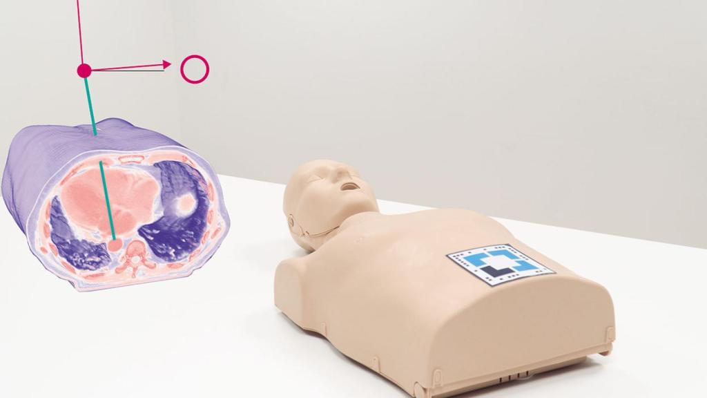 Esta empresa española ayuda a hacer biopsias guiadas con realidad aumentada