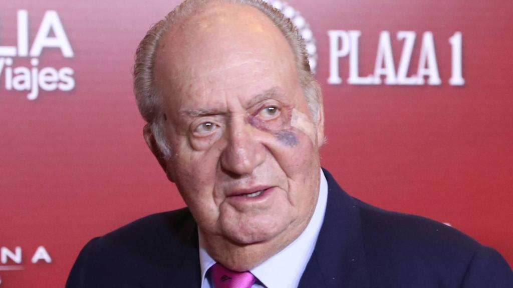 El rey emérito con el ojo morado, en una de sus últimas apariciones.