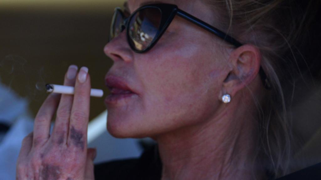 Melanie, en Hollywood con varios hematomas en sus manos.