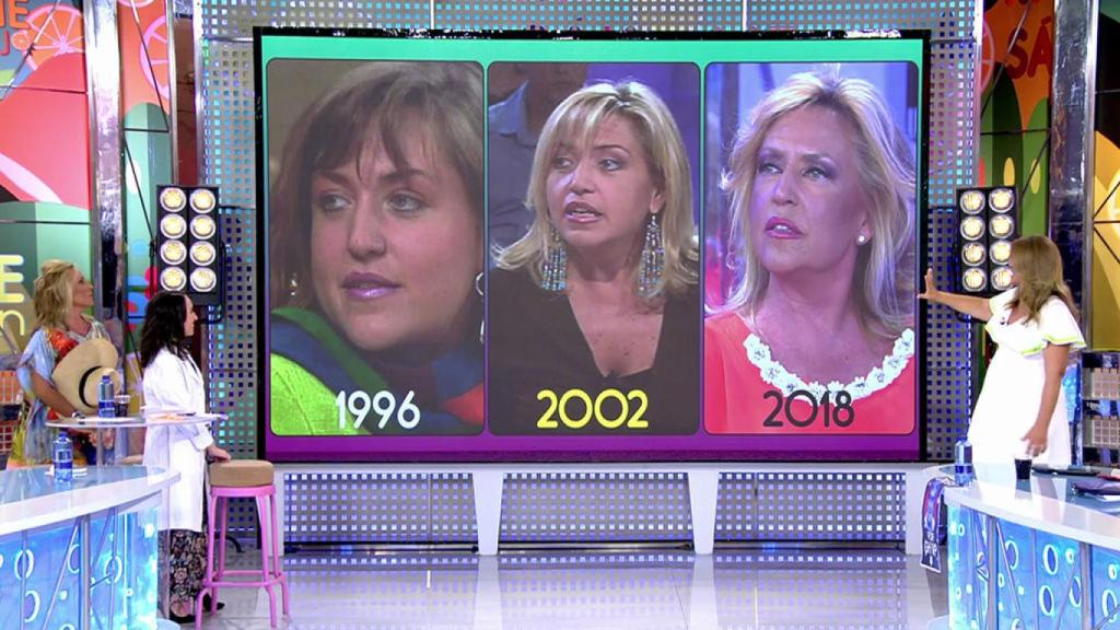 'Sálvame' analizó la evolución de la piel de Lydia en dos décadas.