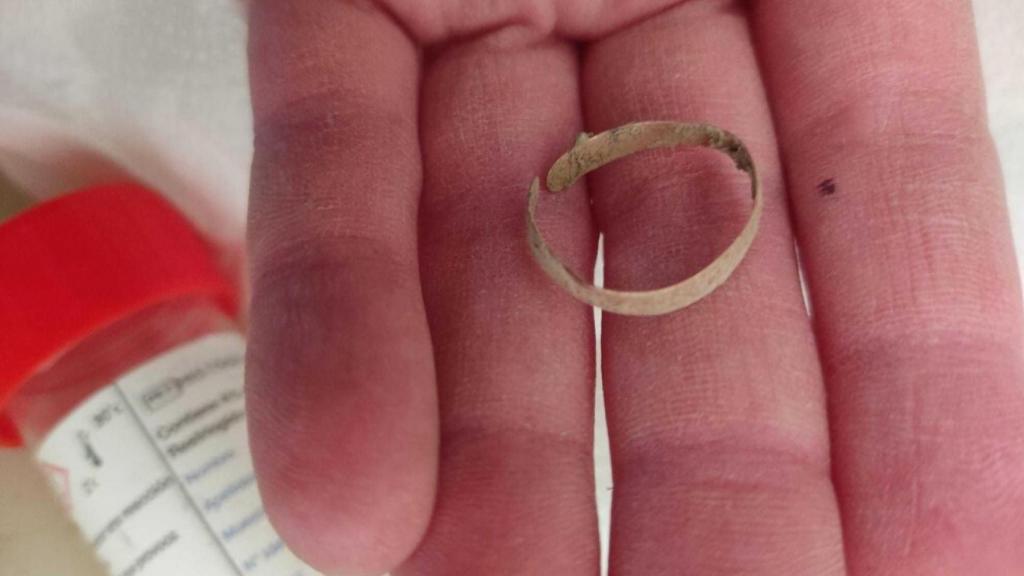 El anillo de oro encontrado en la exhumación de la fosa de las diez mujeres de Uncastillo.