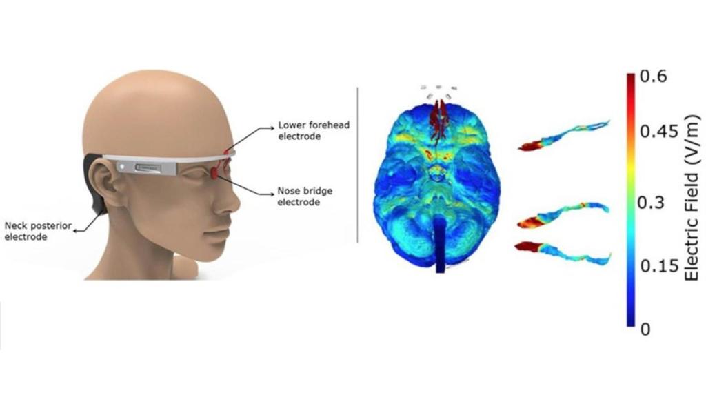 Estas gafas ayudarán a prevenir el alzheimer.
