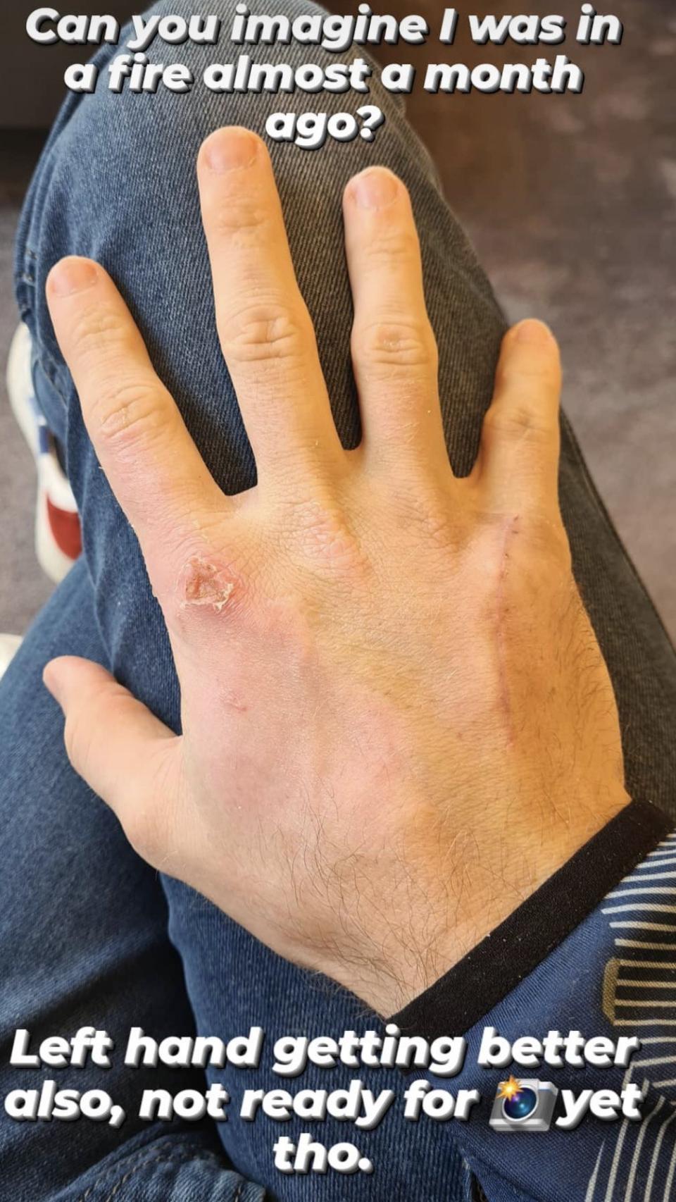 Mano derecha de Grosjean