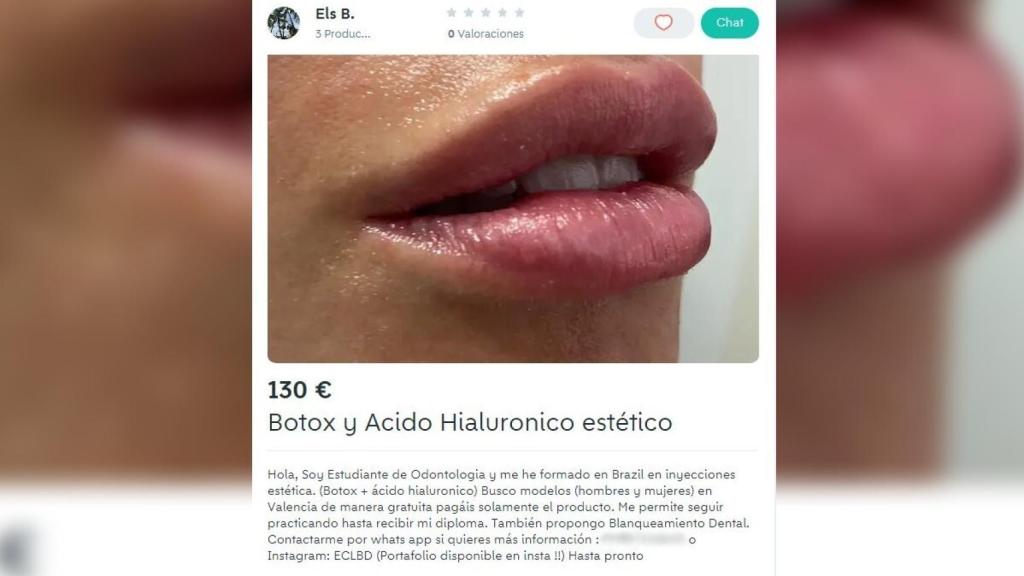 Vista del anuncio publicado en Wallapop por la estudiante de Odontología. EE