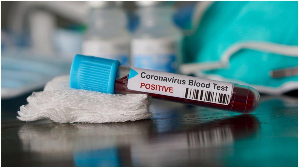 Coronavirus, positivo.