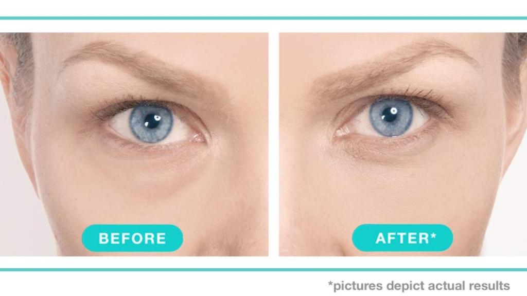 El antes y después de aplicar la crema.