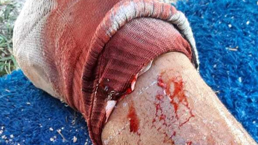 Escalofriante entrada en el fútbol argentino