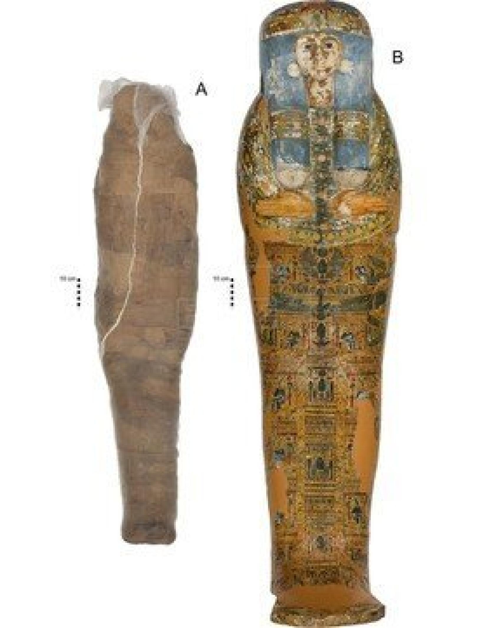 Imagen de la momia completa.