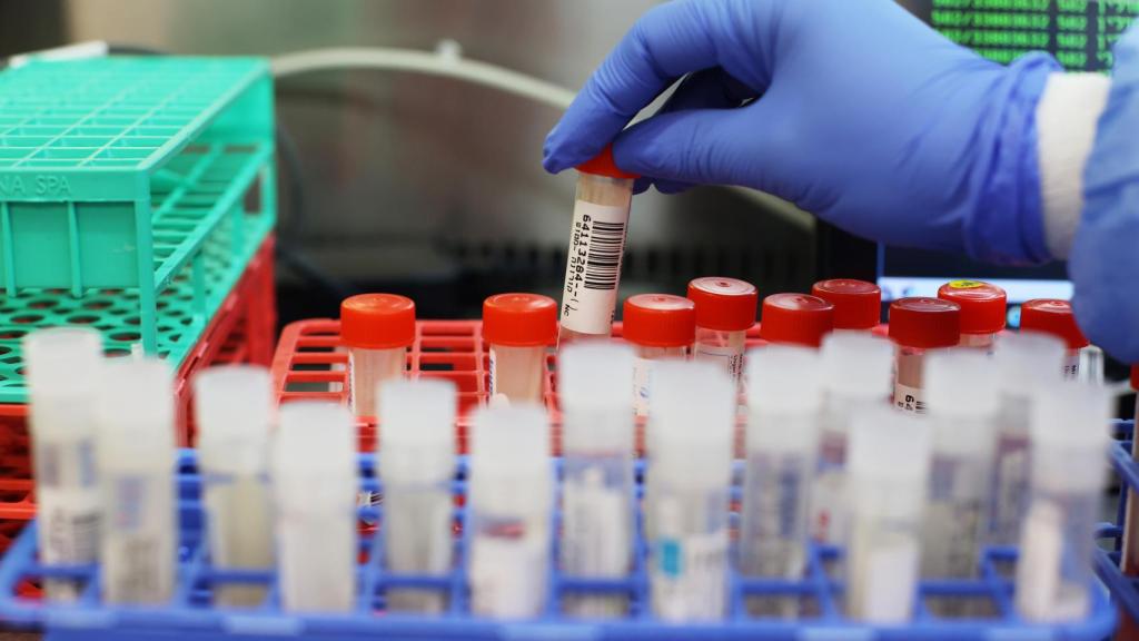 Muestras de sangre de pacientes de Covid-19.
