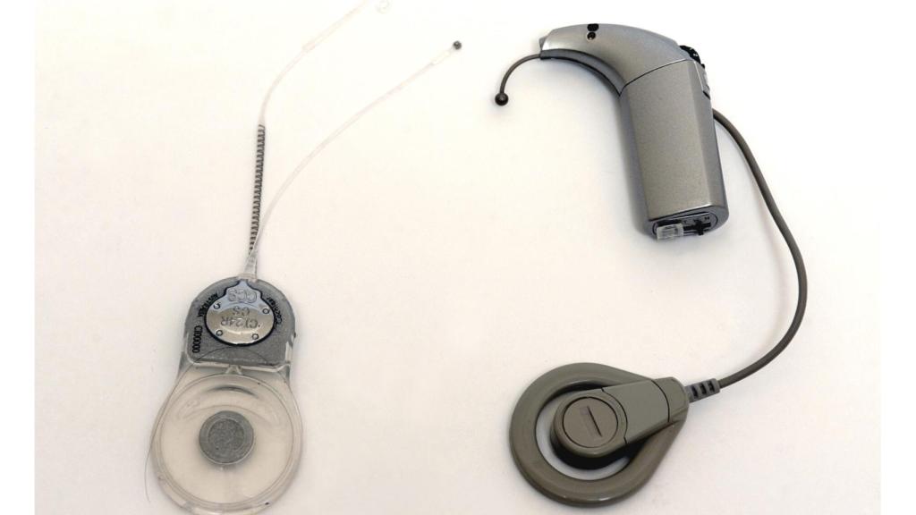 Parte interna y externa del implante coclear