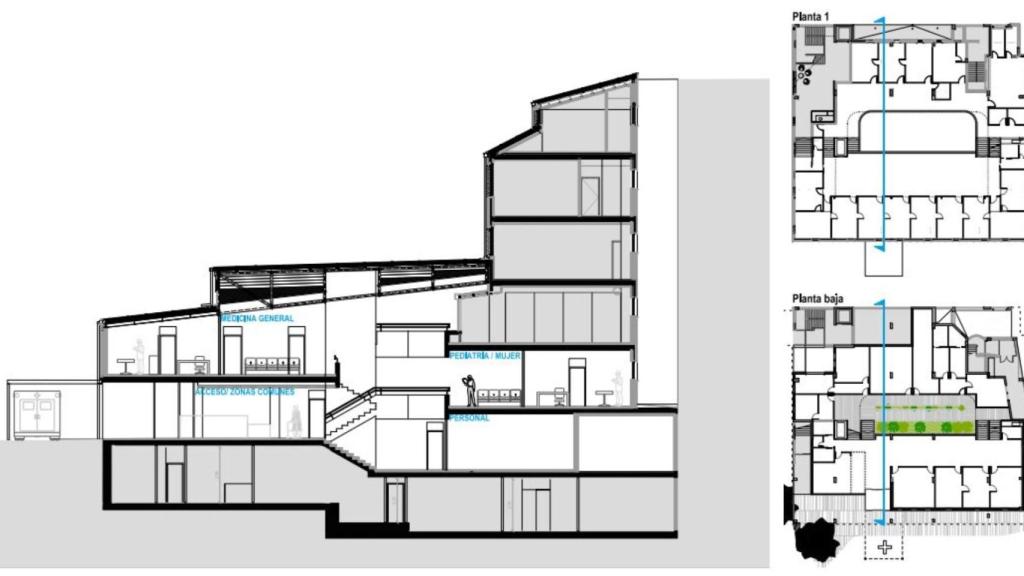 Anteproyecto de Santa Lucía.