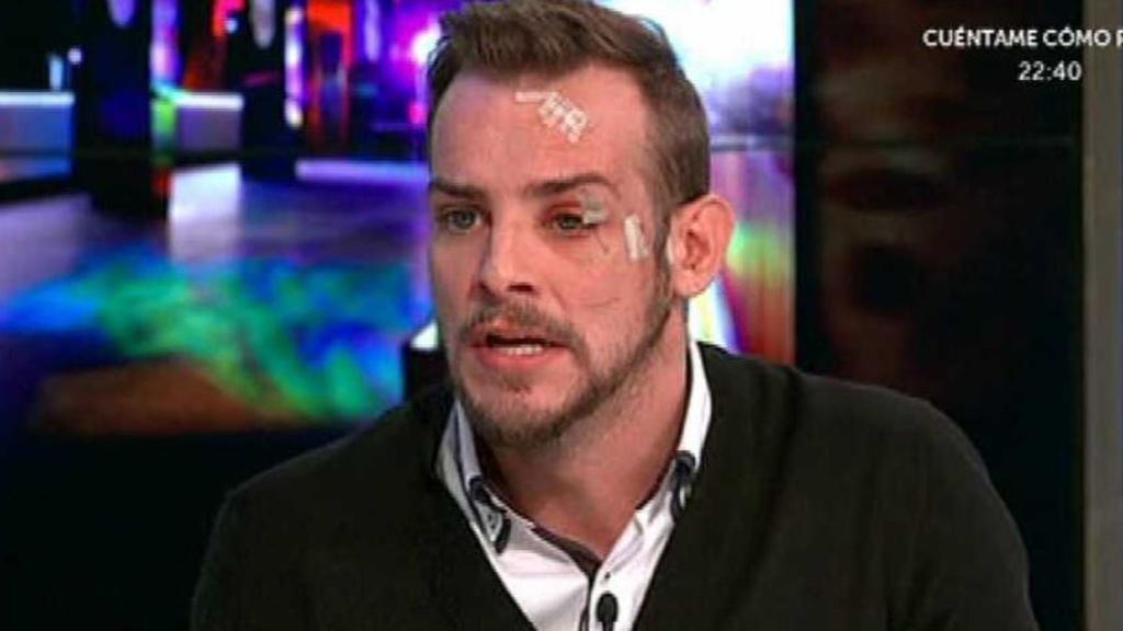 El rostro de Álex tras su sonada pelea en una discoteca de Vigo en 2017.