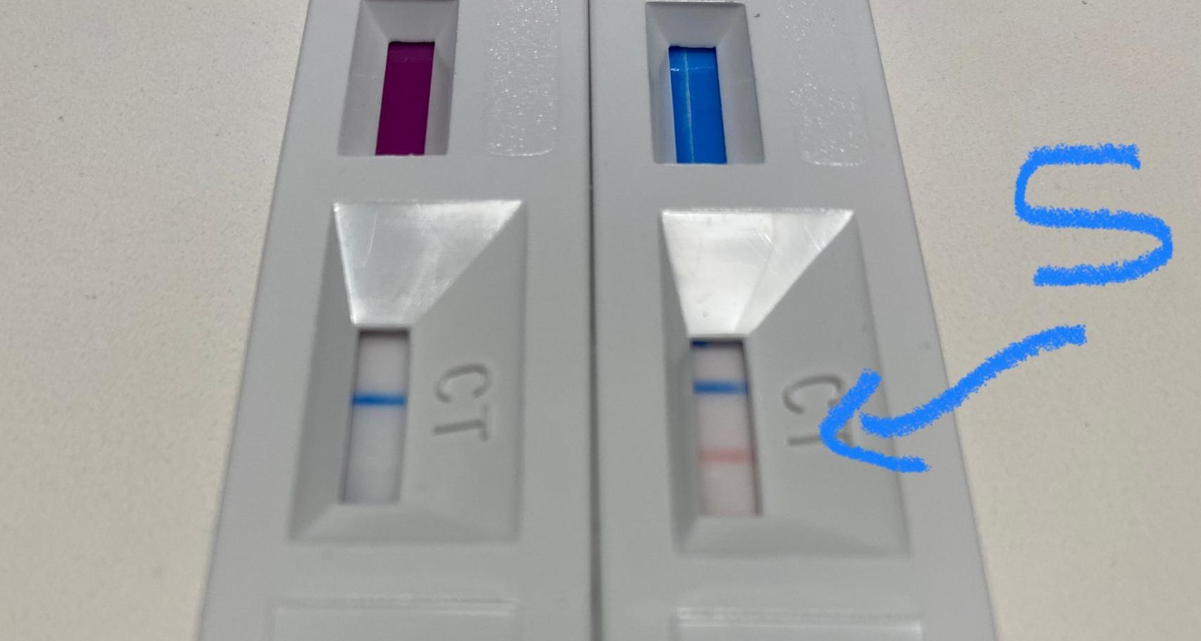 Resultado de los dos test.