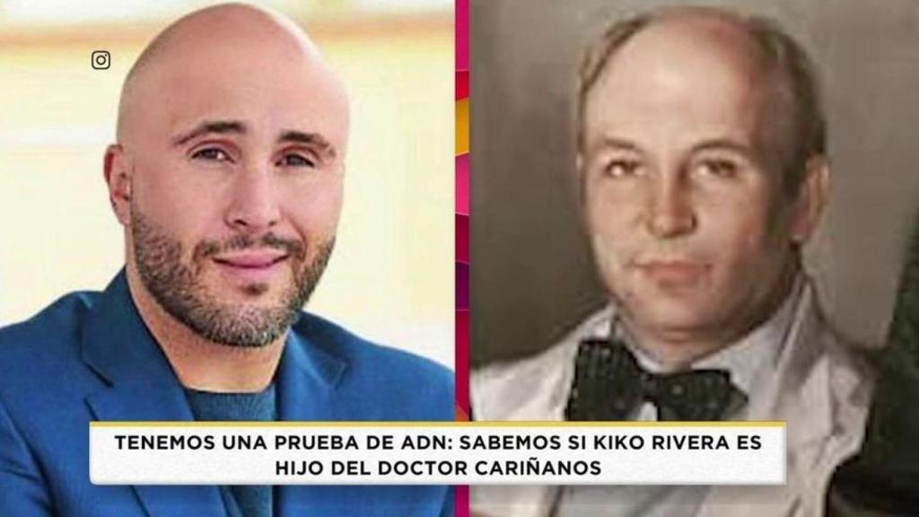 Kiko Rivera en una comparativa junto al doctor Cariñanos en el programa 'Socialité'.