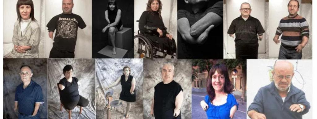 Algunos de los afectados por la talidomida que son socios de Avite.