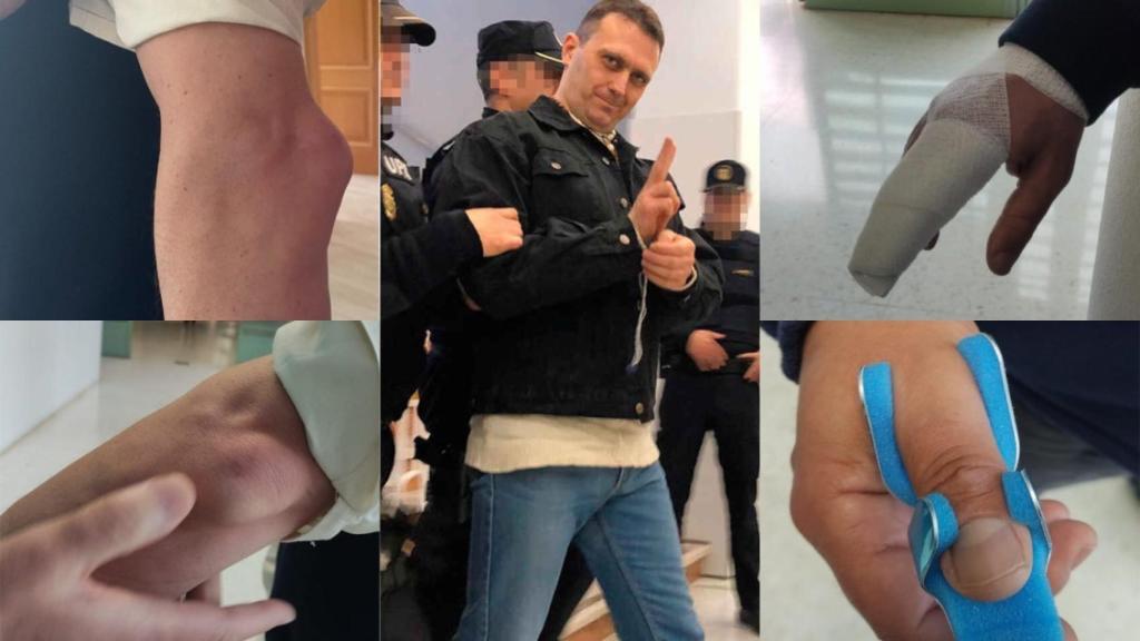 En el centro de la imagen Norbert Feher, alias 'Igor El Ruso'. Y alrededor las lesiones que ha provocado en los funcionarios agredidos.