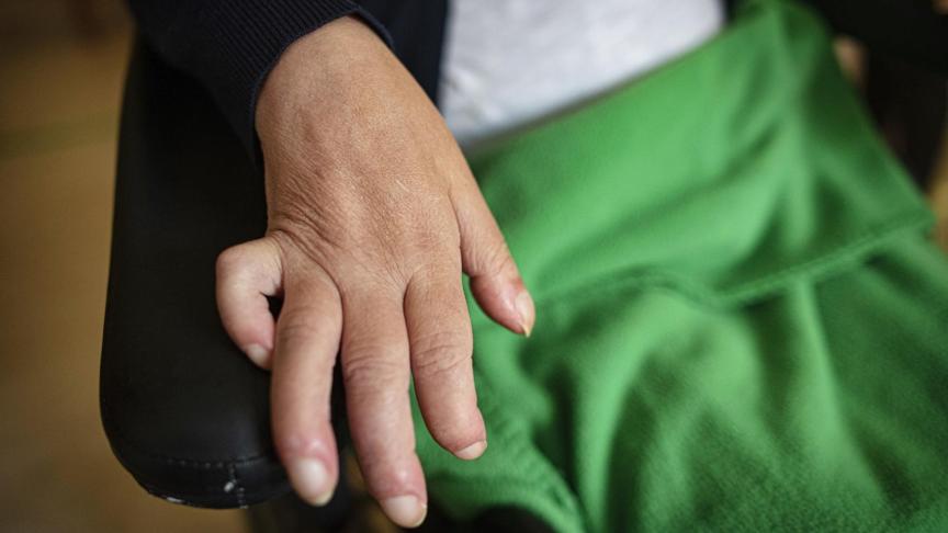 Isa necesita asistencia para asearse, para comer o fumar un cigarrillo, algo que sigue haciendo.