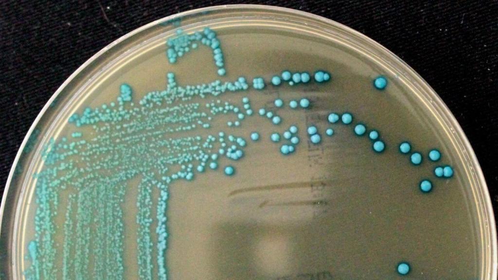 Listeria cossartiae / Catharine Carlin, Cornell University.
