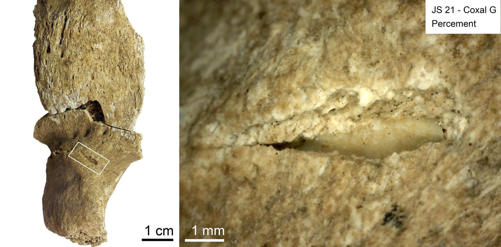 Marcas de impacto de proyectil en uno de los individuos de la necrópolis.