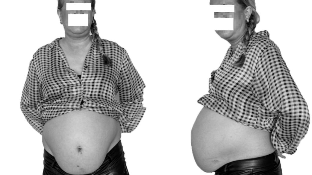 Susana lleva 10 años 'embarazada'.