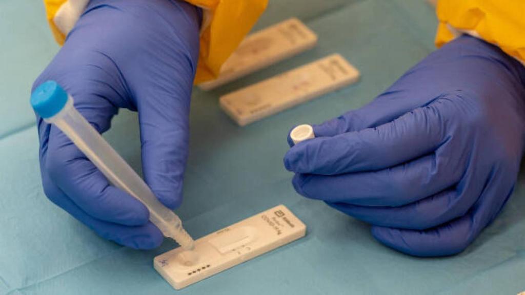 Prueba cribado de covid. Imagen de archivo