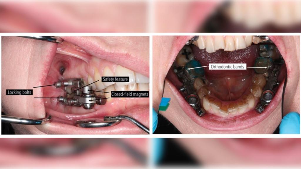 Instalación del sistema.