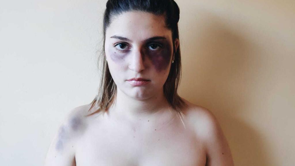 Noelia, maquillada en la imagen para reclamar más protección, recibió ocho puñaladas hace seis años