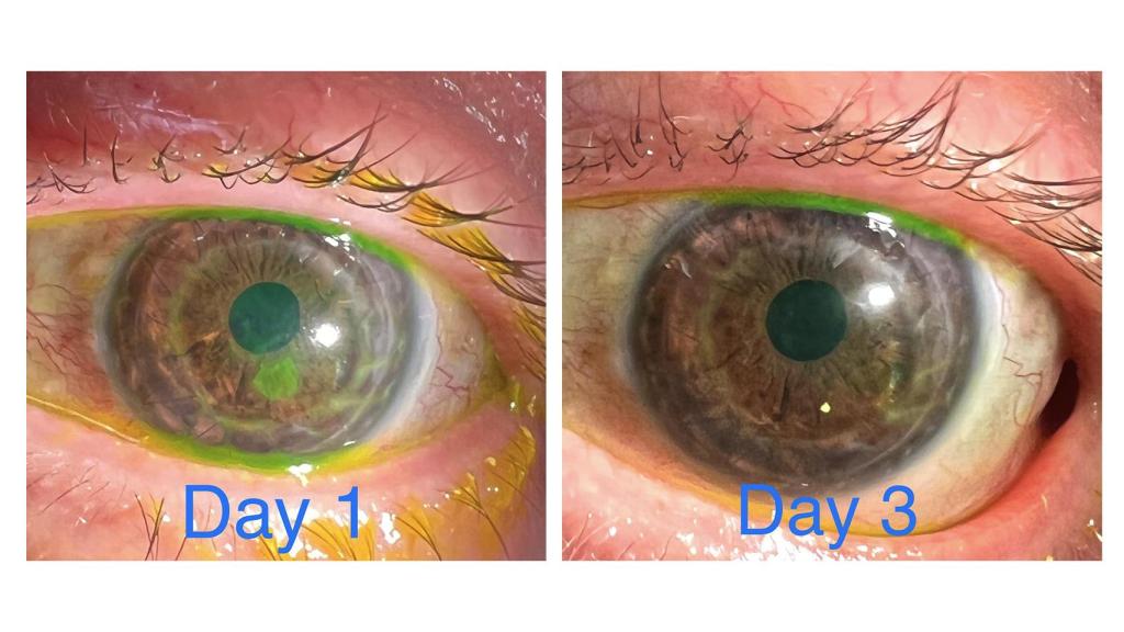 Fotos tomadas con el iPhone 13 Pro Max en modo macro.