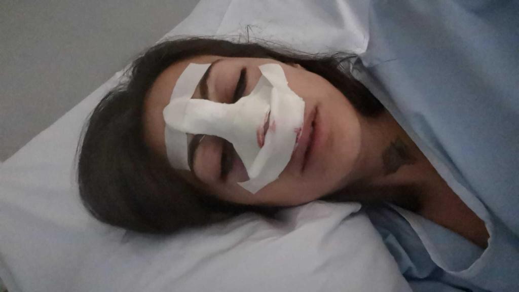 La víctima permaneció ingresada en el hospital.