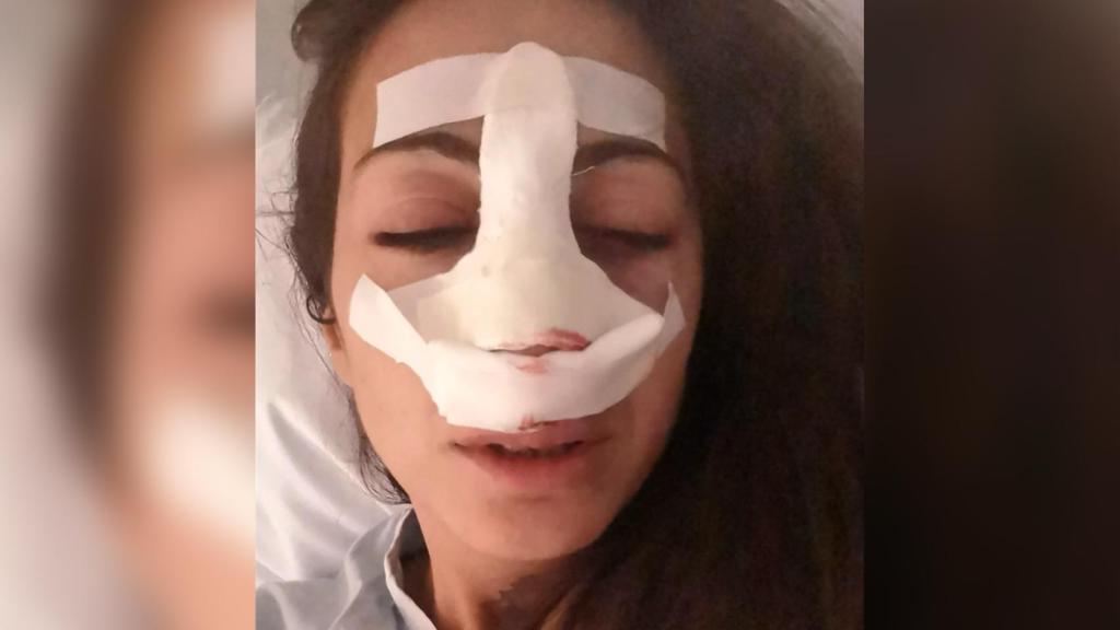 Noa, víctima de una brutal paliza por defender a un perro.