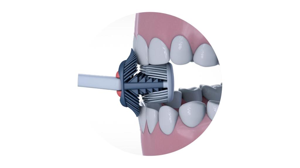 Así funciona Balene.