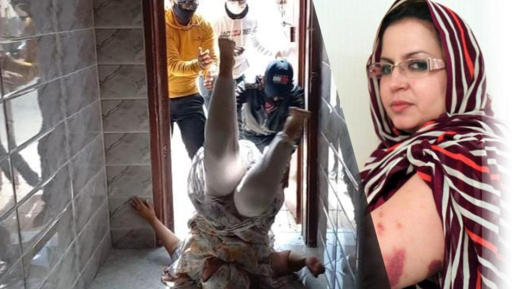 Sultana Khaya en un agresión por agentes de Marruecos en su casa esta semana, según Ángela Carrillo; y con moratones en la otra imagen.