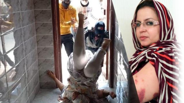 Sultana Khaya en un agresión por agentes de Marruecos en su casa esta semana, según Ángela Carrillo; y con moratones en la otra imagen.