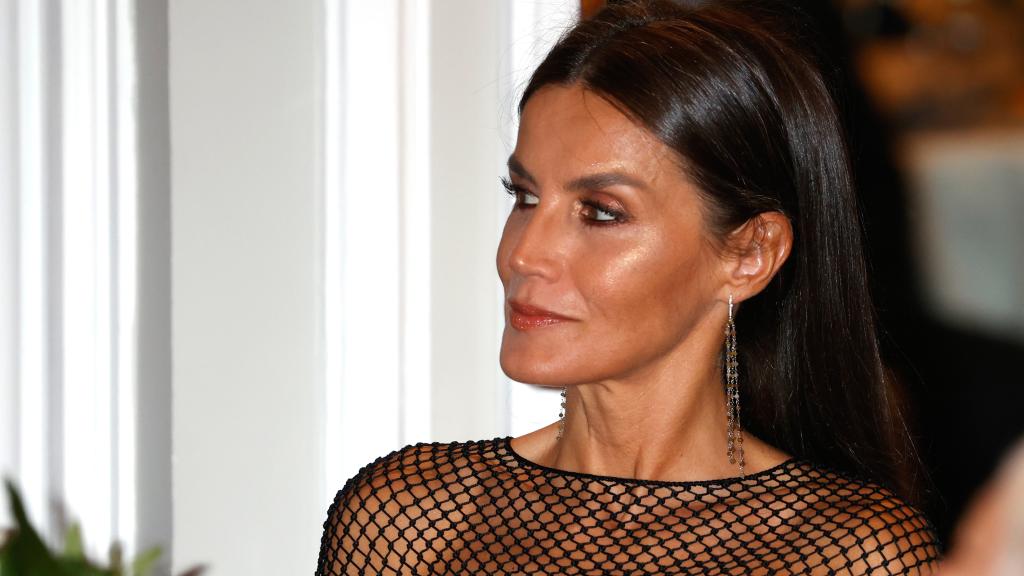 Según el doctor De la Peña, Letizia podría recurrido a varios tratamientos para presentar este magnífico rostro.