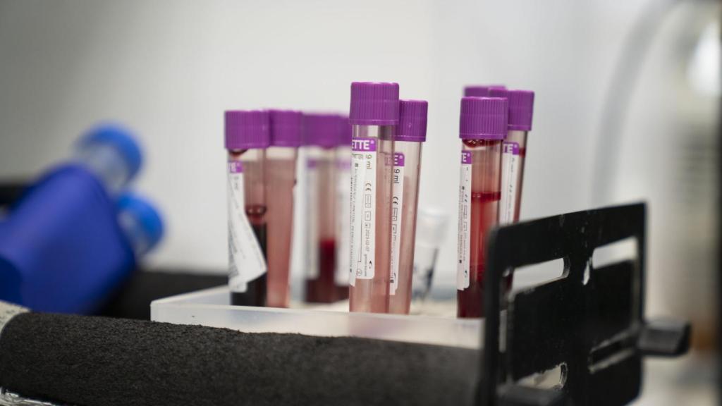 Muestras de sangre en las que se va a analizar la inmunidad a la Covid-19.