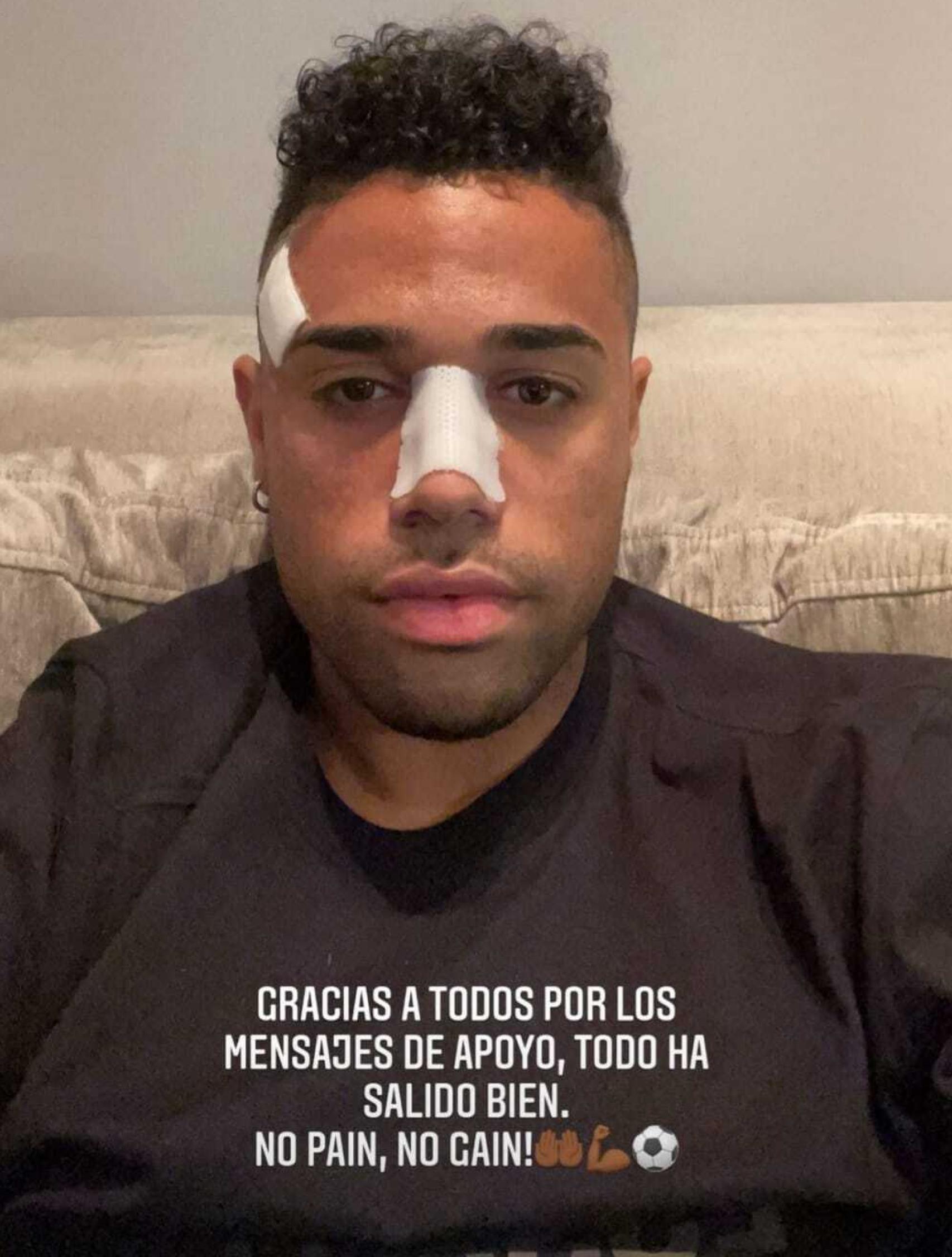 Foto de Mariano Díaz, futbolista del Real Madrid, tras operarse de la nariz