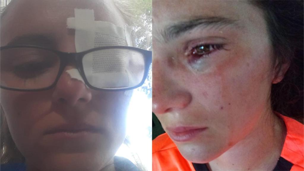 Un fotomontaje que muestra cómo quedó Florencia Botto