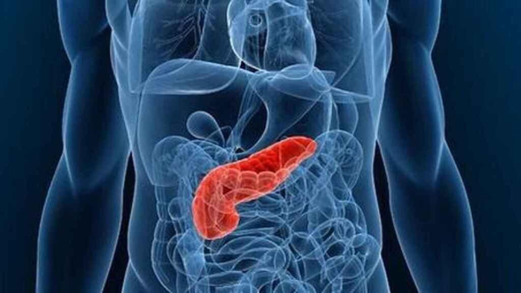 El diagnóstico tardío es una de las causas  de la alta tasa de mortalidad en este tumor.