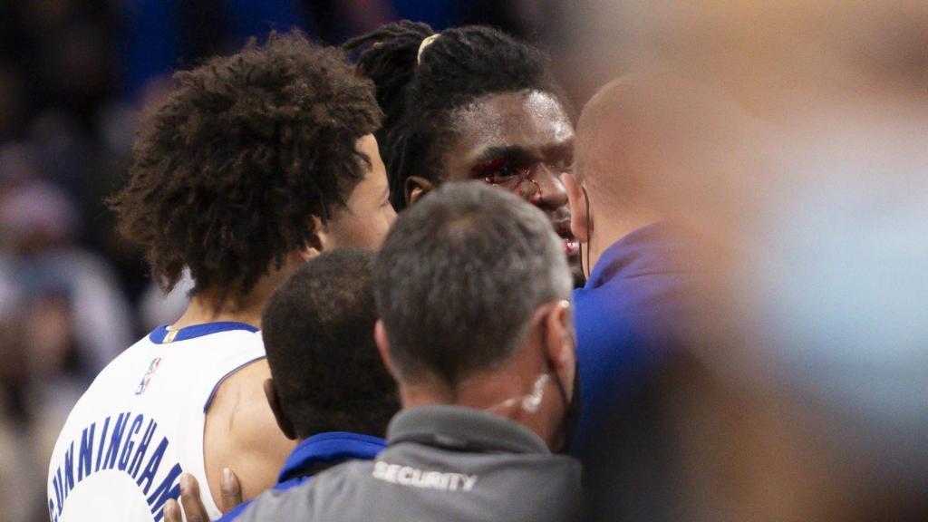 Isaiah Stewart, con la cara ensangrentada tras ser agredido por LeBron James