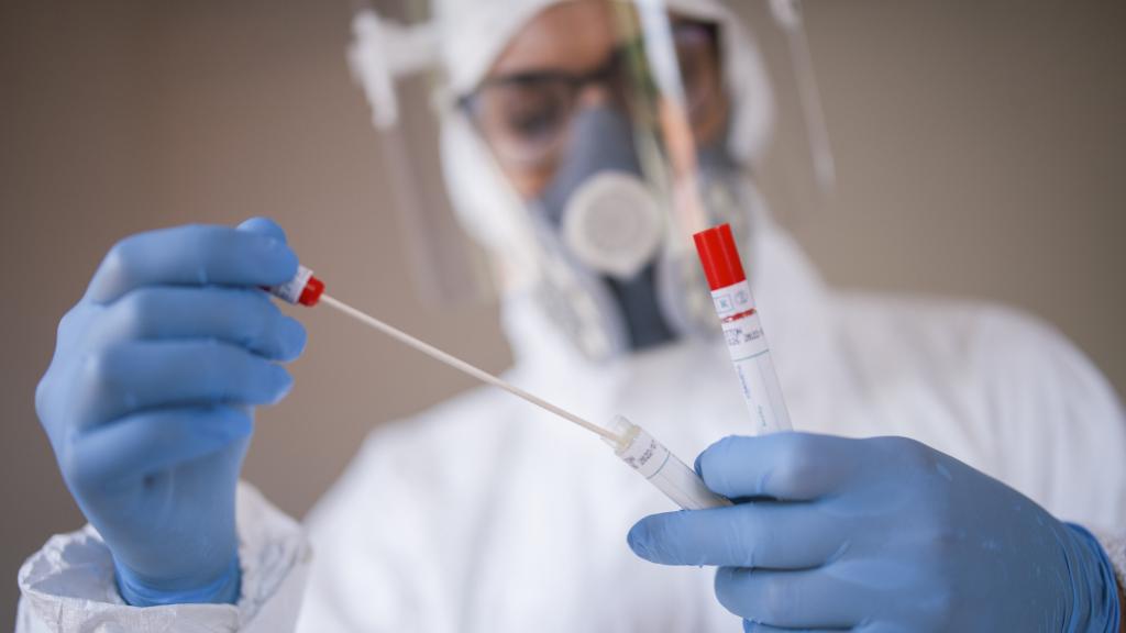 Imagen de archivo de una prueba PCR.