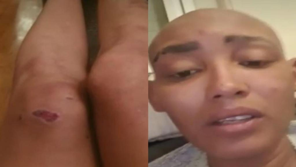 Elayne, la joven agredida, en su aparición en 'Espejo público'.