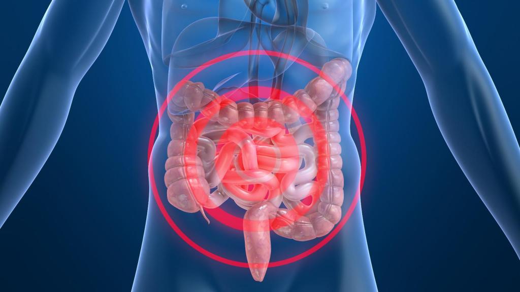 Síndrome de malabsorción de alimentos.