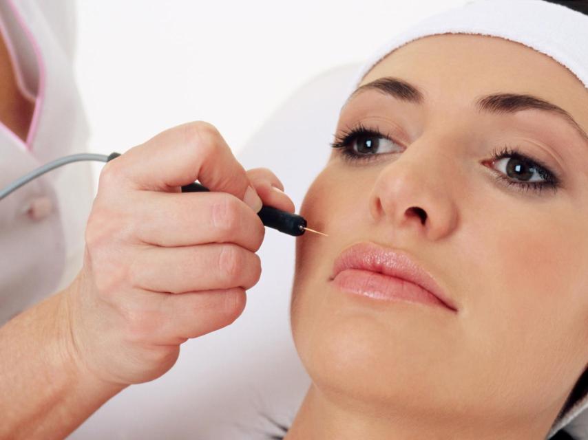 Una modelo inyectándose toxina botulínica.