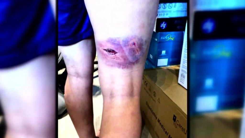 Las heridas de Kheira Hamraoui.