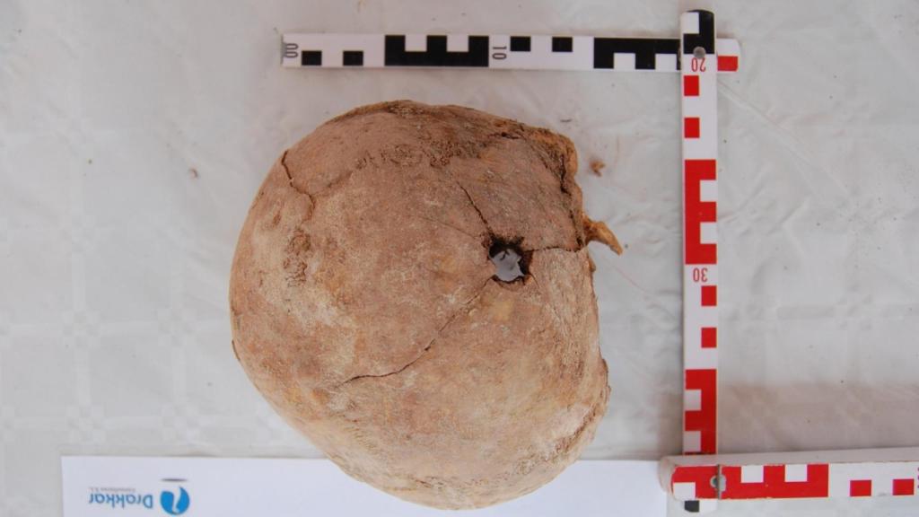 Uno de los cuerpos encontrados presenta un orificio de salida de bala en el cráneo.