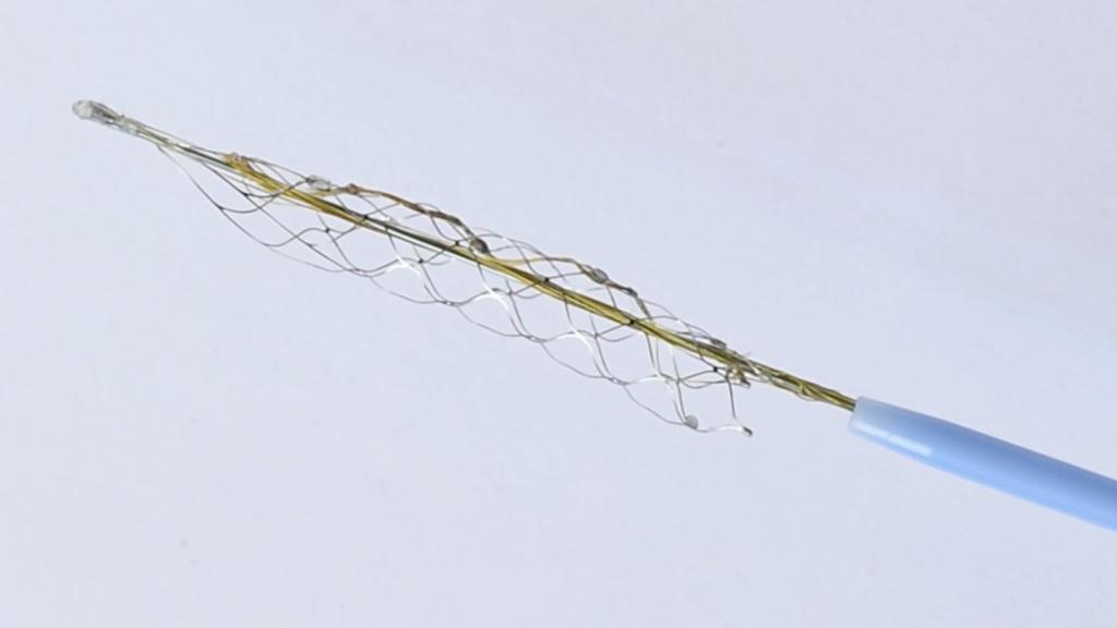 Stentrode, implante cerebral