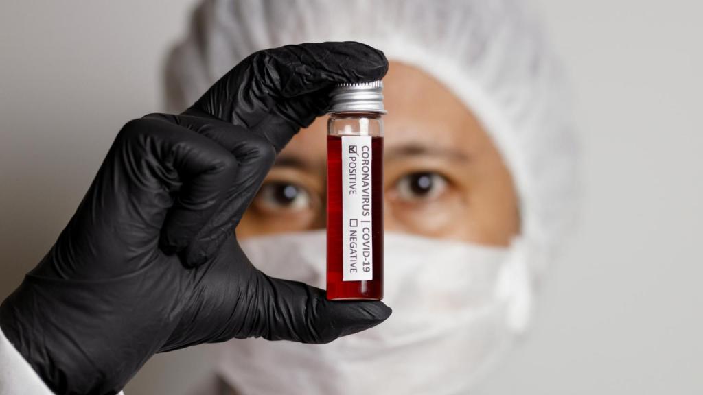 Muestras de sangre para analizar el coronavirus SARS-CoV-2.